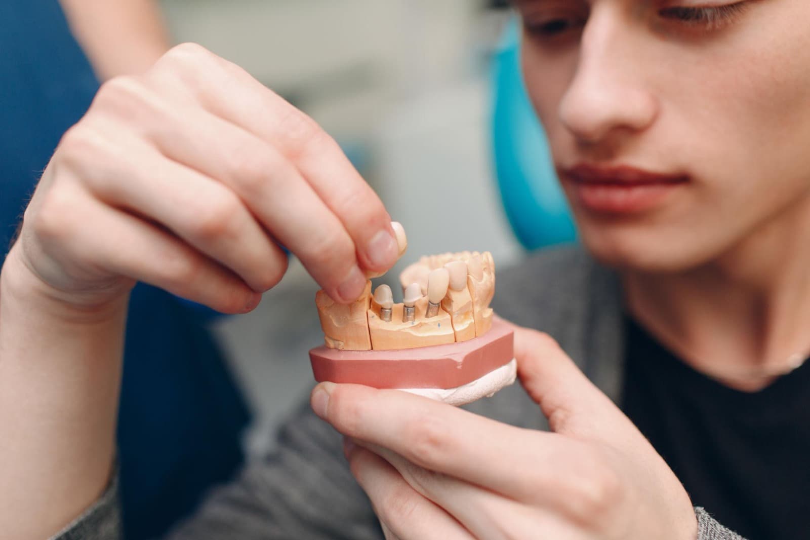 Dental Implant and Crown promotion at Otahuhu Dental Care